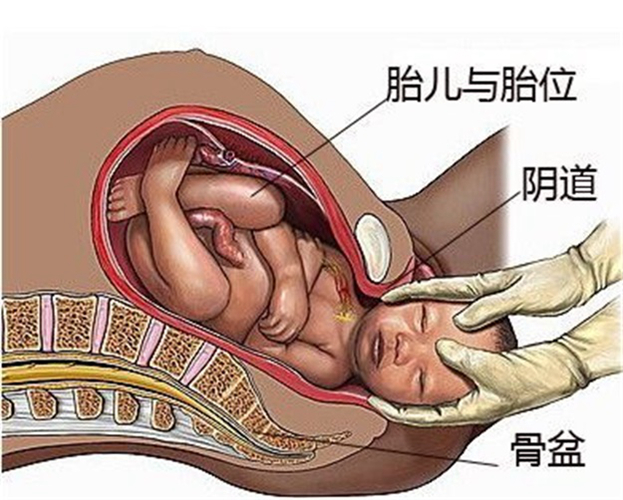 動漫孕婦分娩圖片