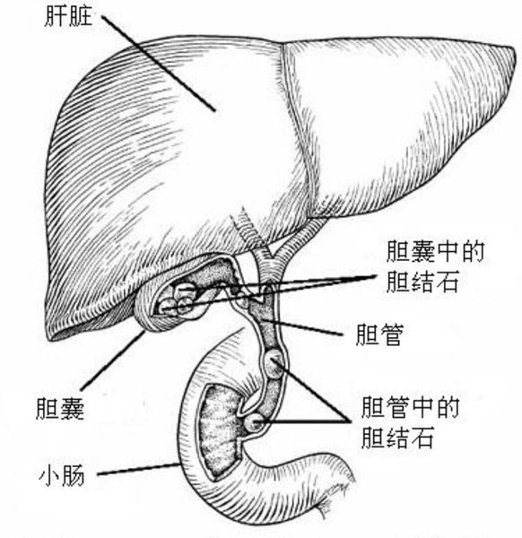 胆汁不是由胆囊分泌的,是由肝脏分泌的,胆囊的主要作用是储存,浓缩