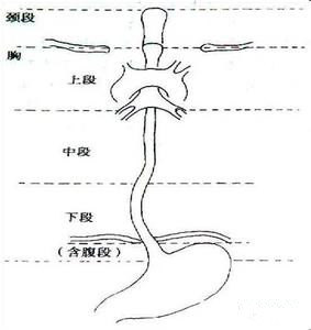 食管癌治疗方案的选择