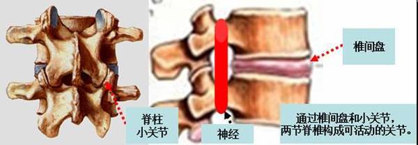 1,由于姿势不良或者外伤导致 脊柱小关节 位置失调,小关节出现