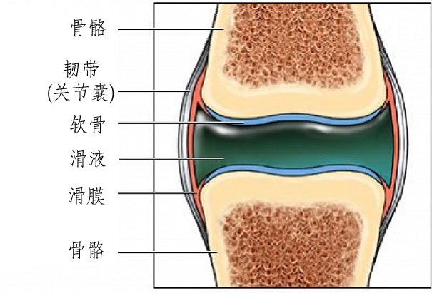 什么是滑膜炎,关节积液?