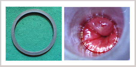 4035849188.jpg 025175cd456a7fc7bf8c222bd85b8c42正本.jpg