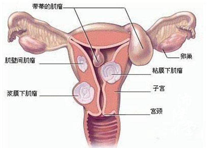 更年期婦女的子宮脫垂圖解圖片