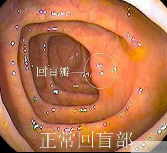 认识肠镜下结直肠的正常形态