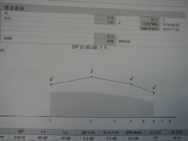 检查见患儿发育正常,营养中等,双耳鼓膜完整,标志清楚,耳声发射双耳d
