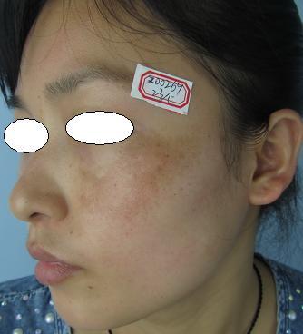 ooYBAFcJ7OOAQnN-AABc44iKV8w281.jpg