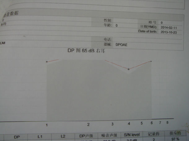 检查见患儿发育正常,营养中等,双耳鼓膜完整,标志清楚,耳声发射双耳