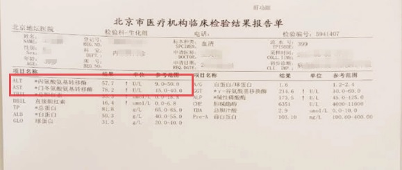 转氨酶升高就一定是得了肝炎吗?