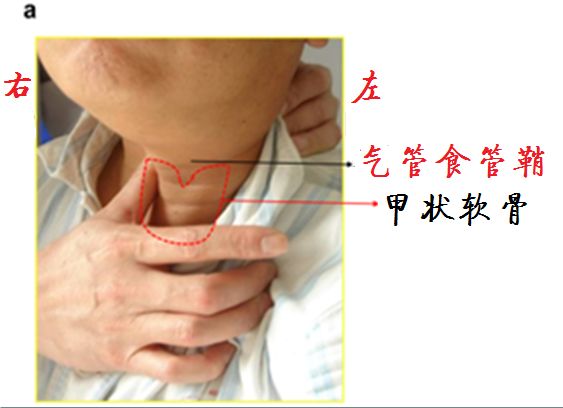 气管推移训练怎么做?