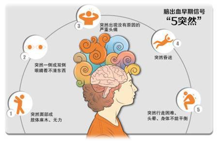 脑出血是什么?