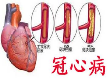 冠心病的危险因素及预防小常识