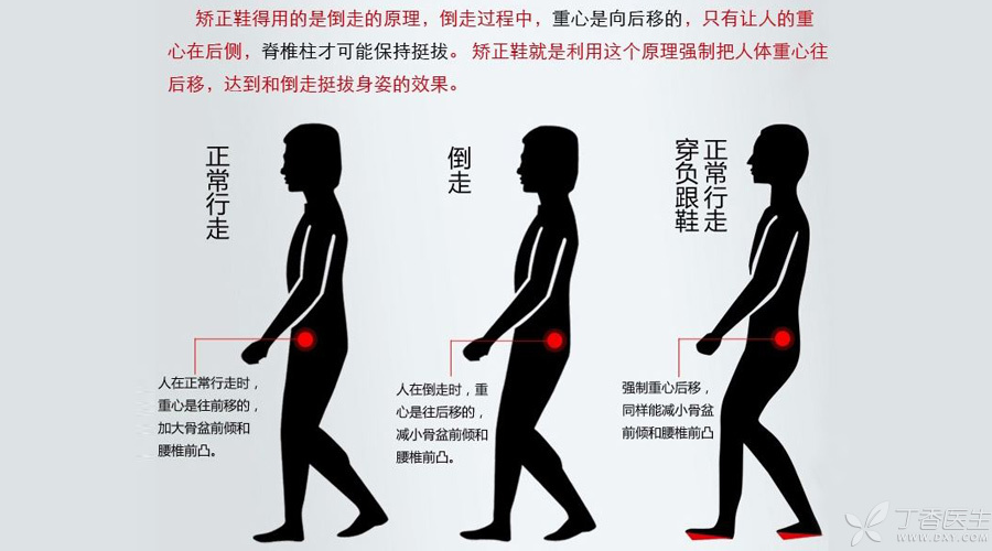 倒走锻炼,是好是坏?