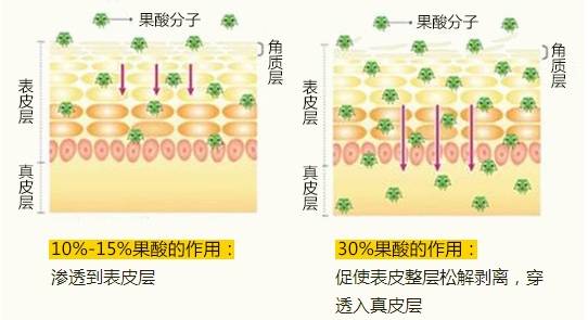 果酸如何焕肤-有来医生