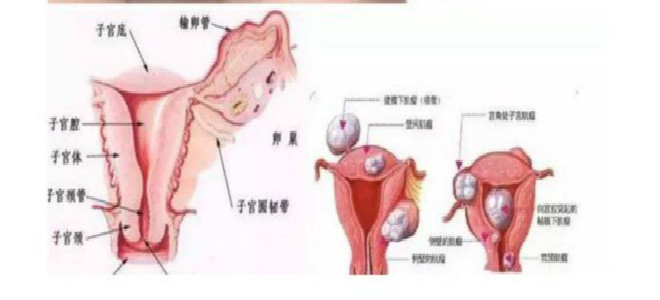 輕度子宮糜爛圖片