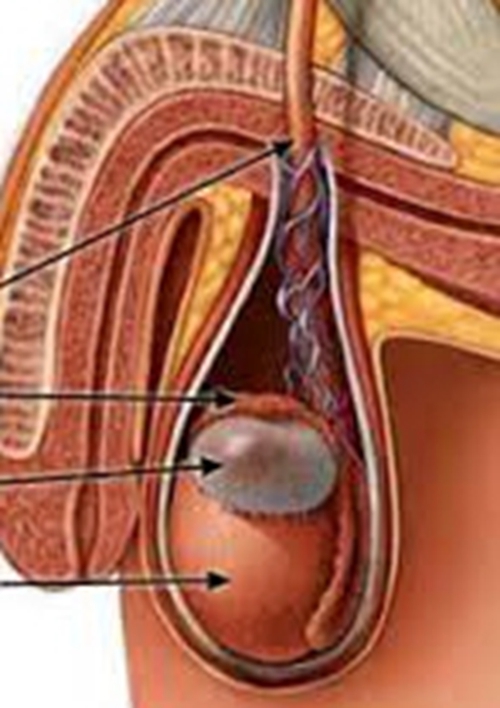 睾丸疼痛图片