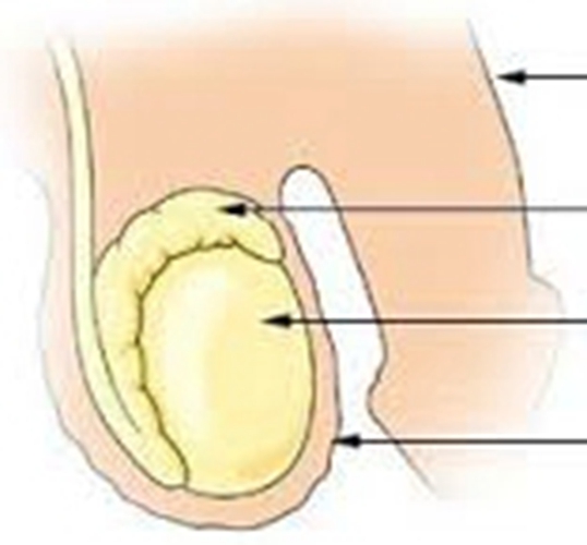 睾丸形状的解析图图片