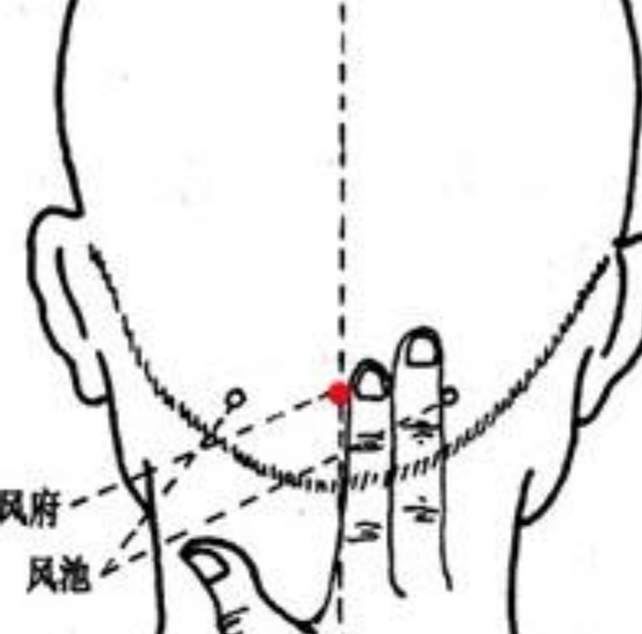 头部穴位的图片