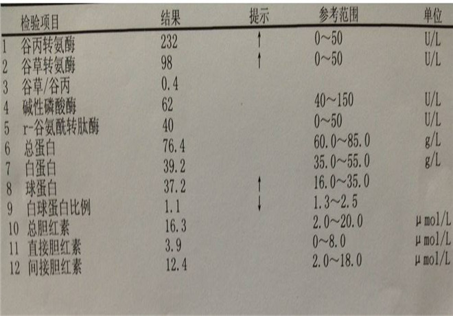 肝功能化驗單解讀hva