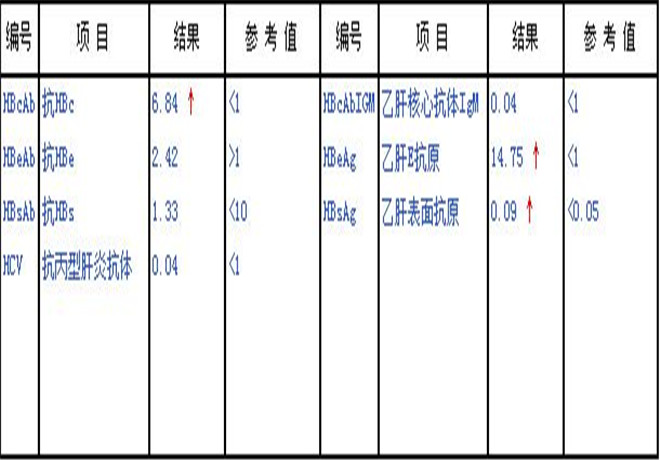 肝功能化驗單正常值