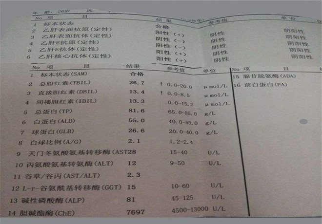 丙肝肝功能化验单_有来医生