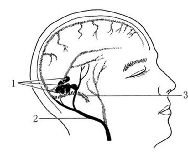硬脑膜窦图片