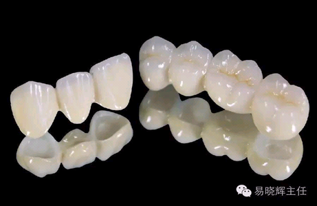 全瓷牙与普通烤瓷牙的区别