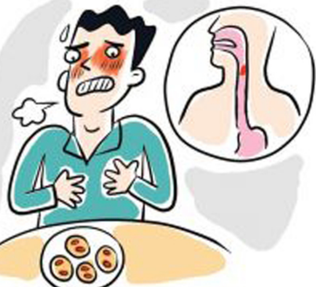 食道癌的症状：食管异物感、喉咙有干涩感和压迫感—【NMN观察】