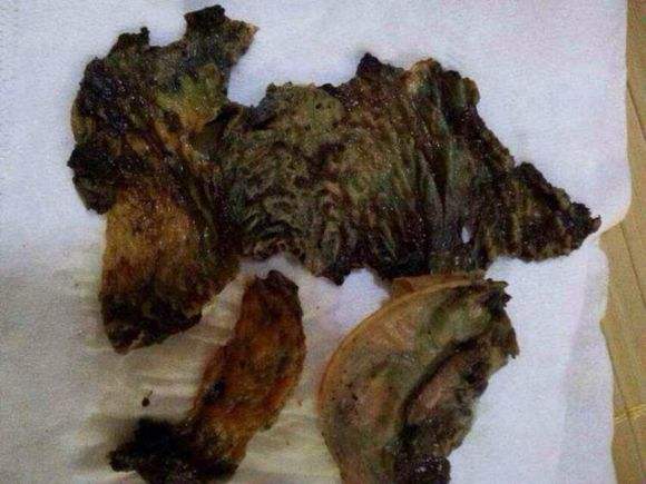 子宮糜爛切除物圖片