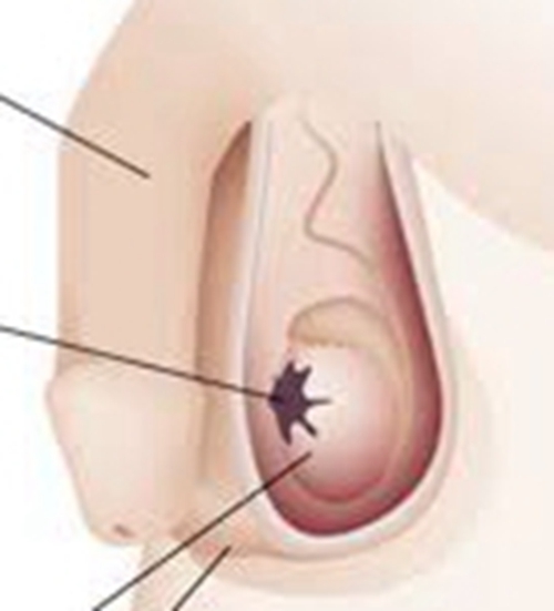 睾丸形态特征图片