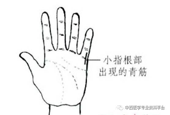 如果只是出在左侧(靠大拇指一侧的为左),表示左侧脑动脉硬化及经络不