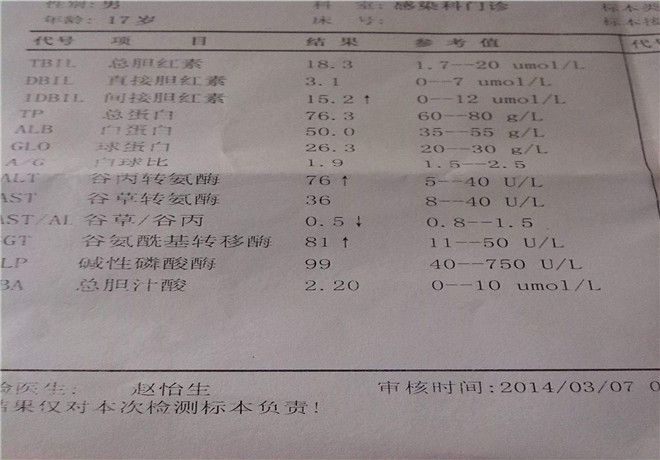 丙肝肝功能化驗(yàn)單