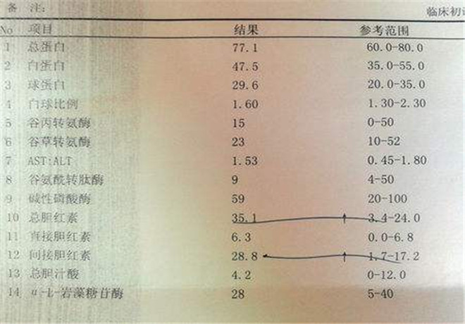 肝功能化驗單解析總膽紅素