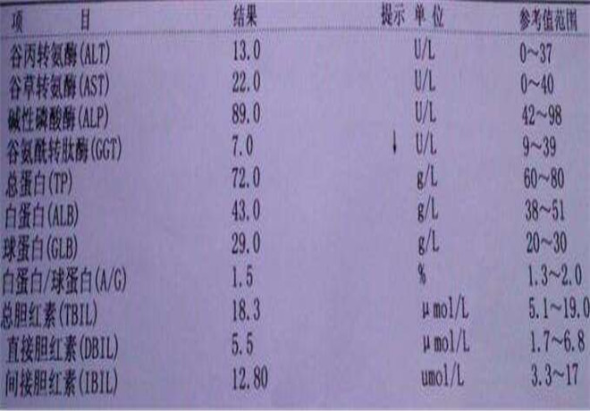 肝功能化驗單指標