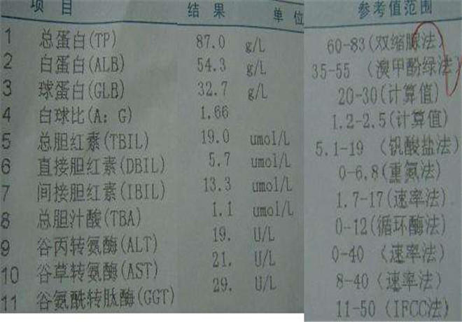 肝功能化驗單谷丙