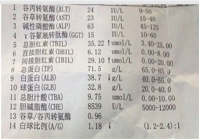 肝功能化驗單樣板