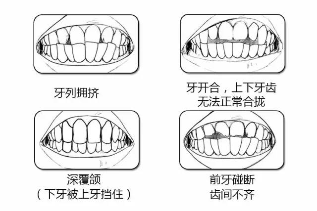 三招自测牙齿整齐程度,第一招就闪亮你的眼