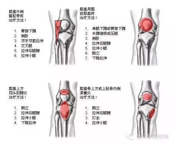 膝关节的疼痛部位有哪些