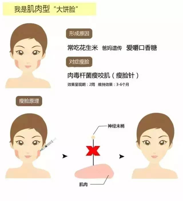 脸大有哪些原因?