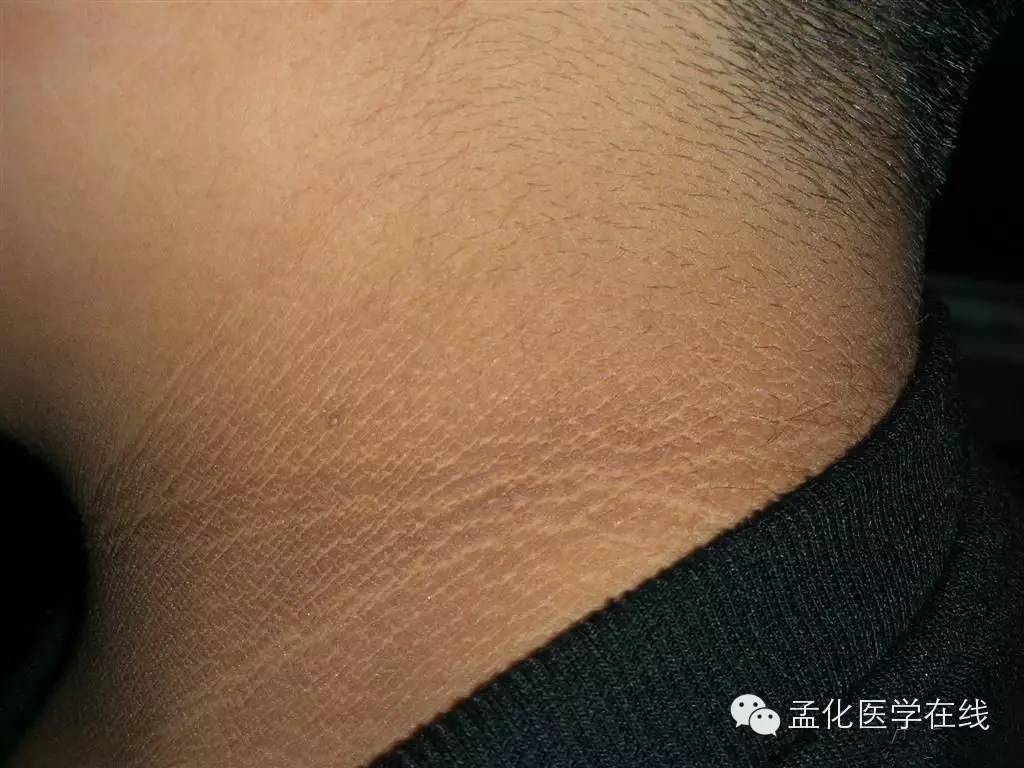 抑郁也许是一种重要的情绪