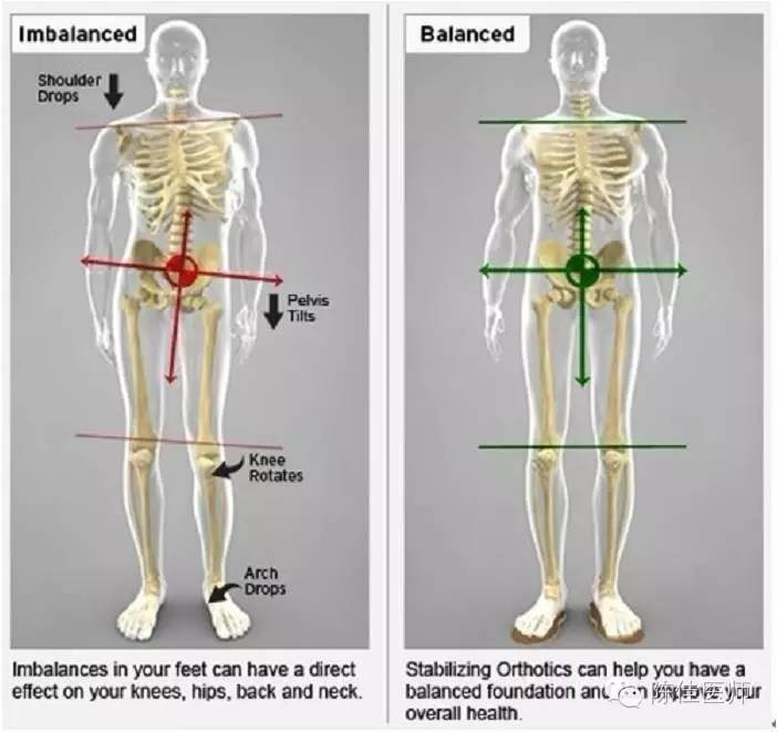 长短脚是源自于后天的不良姿势习惯,摔跤,骨折等症状引起的骨盆旋转