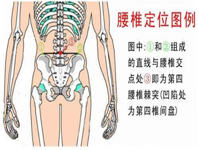 小針刀治療腰間盤突出