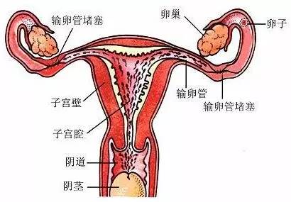 输卵管通畅检查,输卵管通畅检查最好在什么时候,输卵管通畅检查只认广州南粤