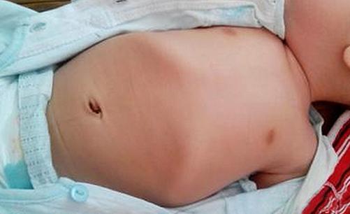 鸡胸