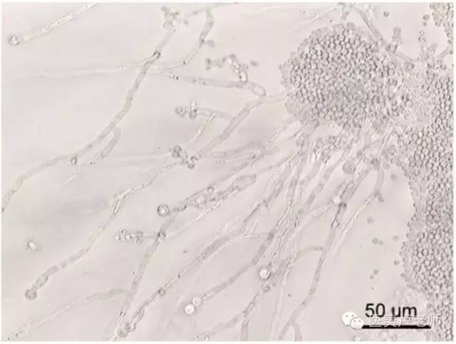 7,肠道细菌:白色念珠菌(candidaalbicans)