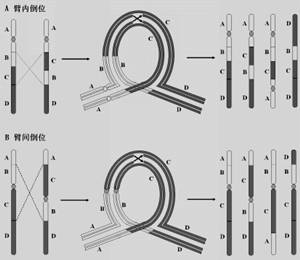 染色体倒位是怎么回事