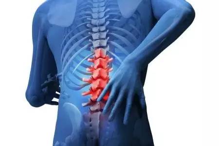 腰椎滑脱主要有哪些症状?