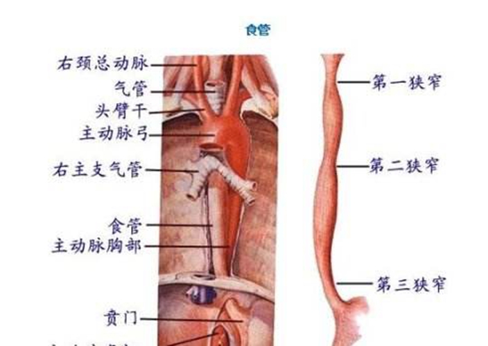 反流性胃食道炎