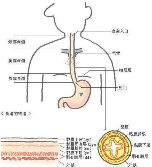 食道炎