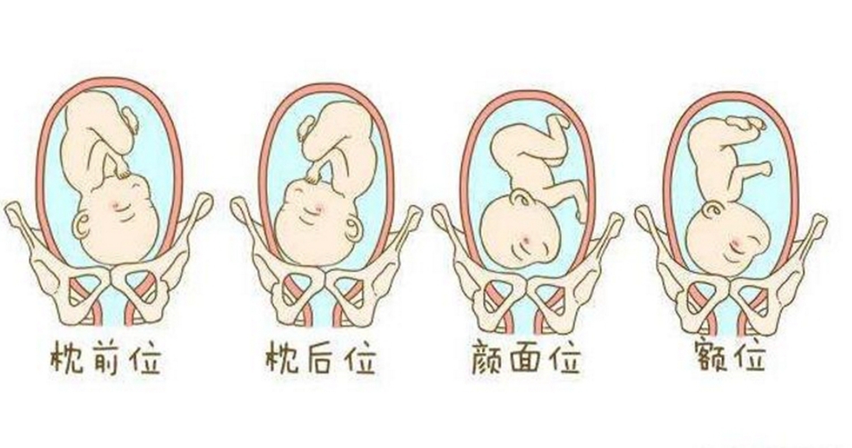 如何判断胎方位的示意图