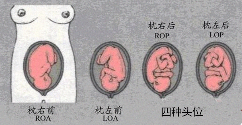 胎方位是loa四种方位的图片